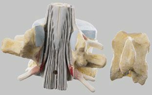 脊髄付第2腰椎模型　BS28