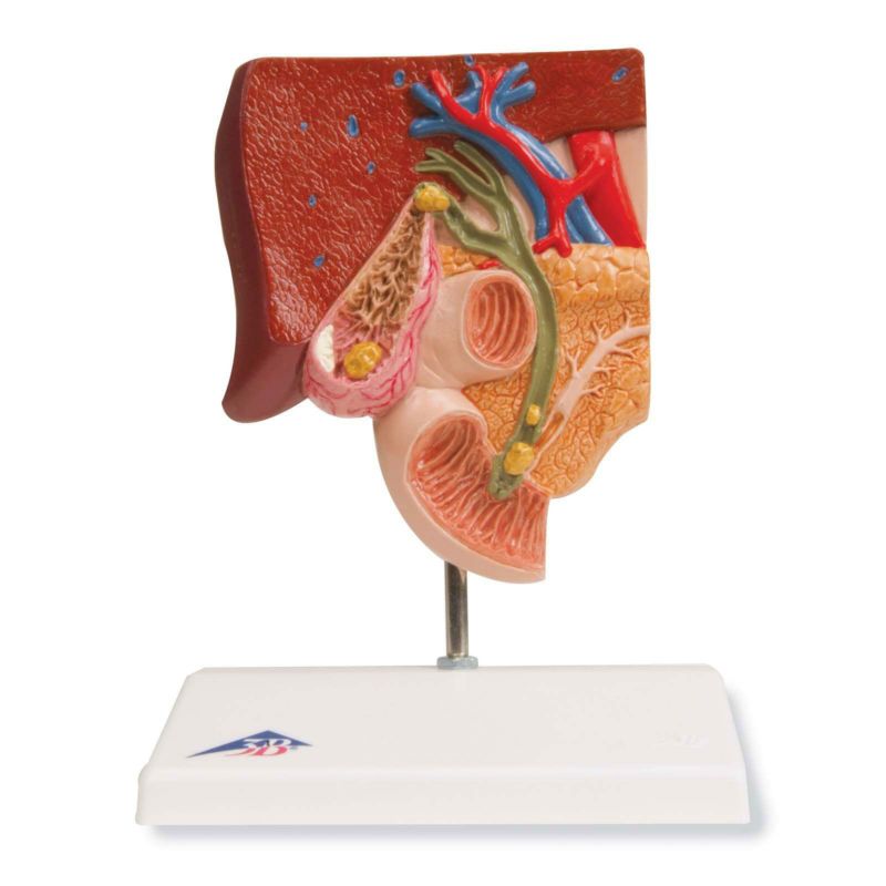 胆石モデル　K26