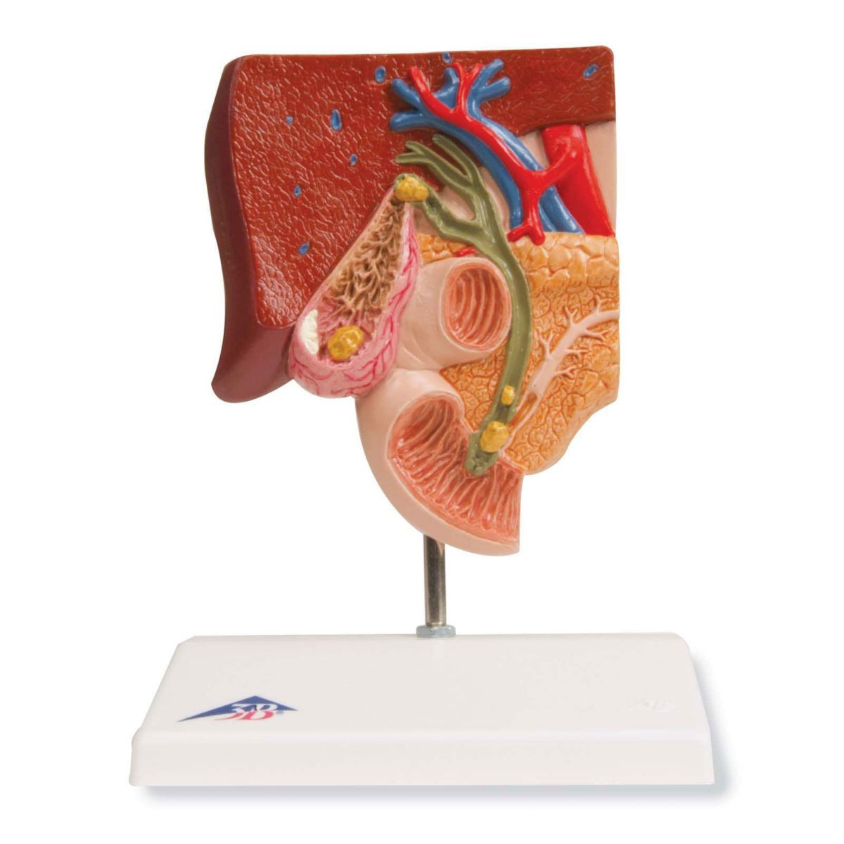 胆石モデル　K26