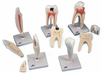 上顎大臼歯（3根）モデル、縦断3分解　D10 5