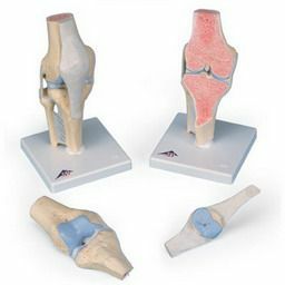 膝の関節断面、3分解モデル　A89