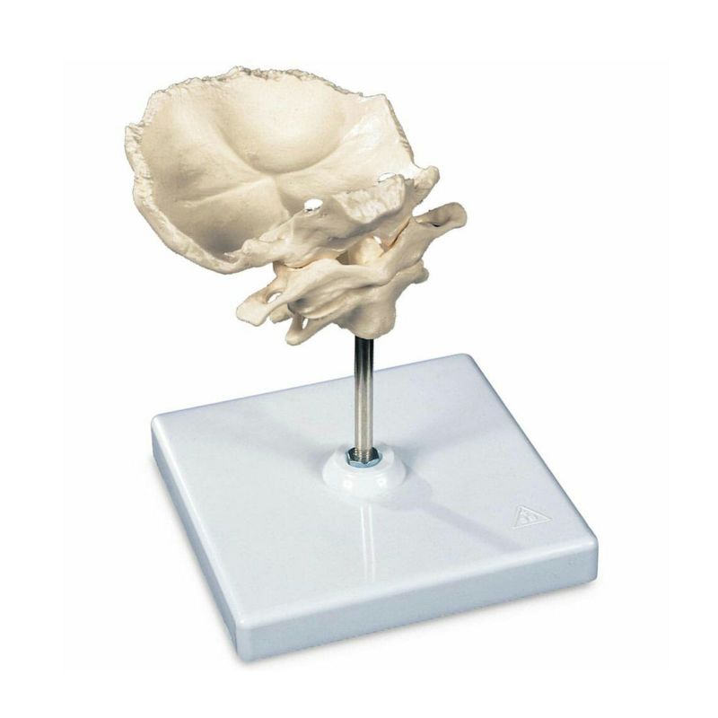 環椎と軸椎モデル、後頭骨・スタンド付　A71 5