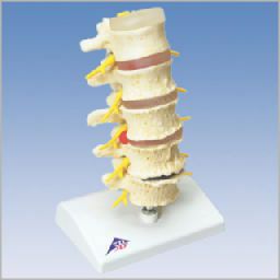椎間板ヘルニアと変形性脊椎症モデル　A795