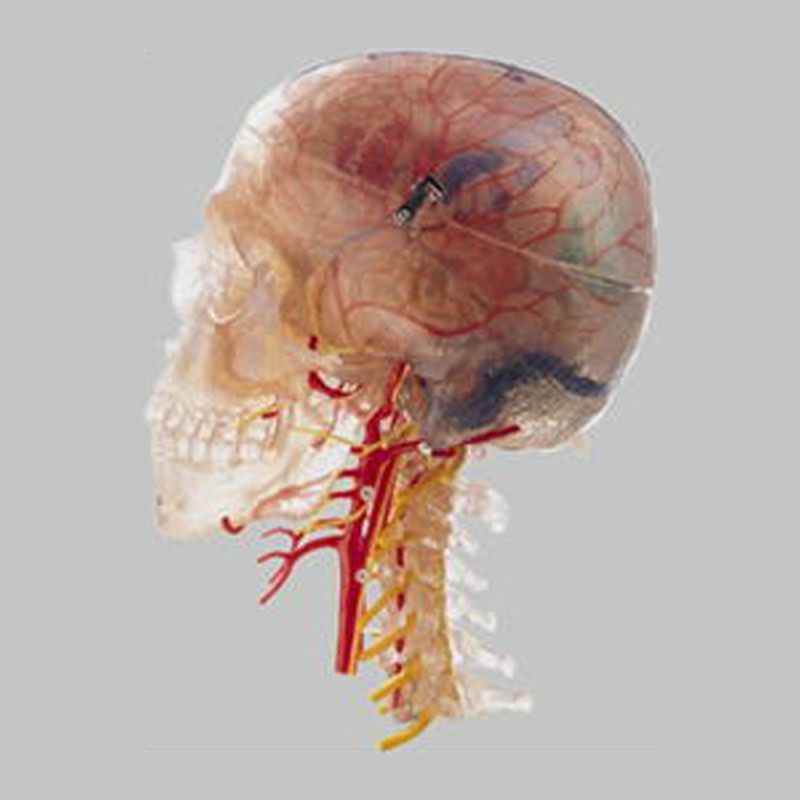 頸椎付頭部模型