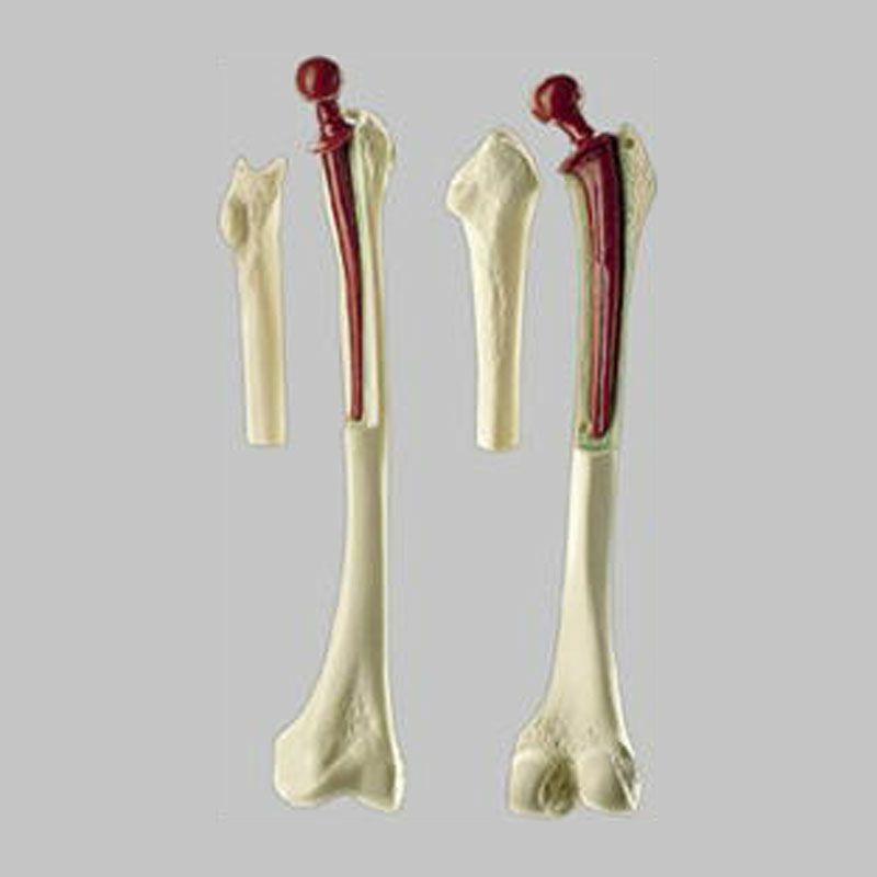 人工大腿骨模型