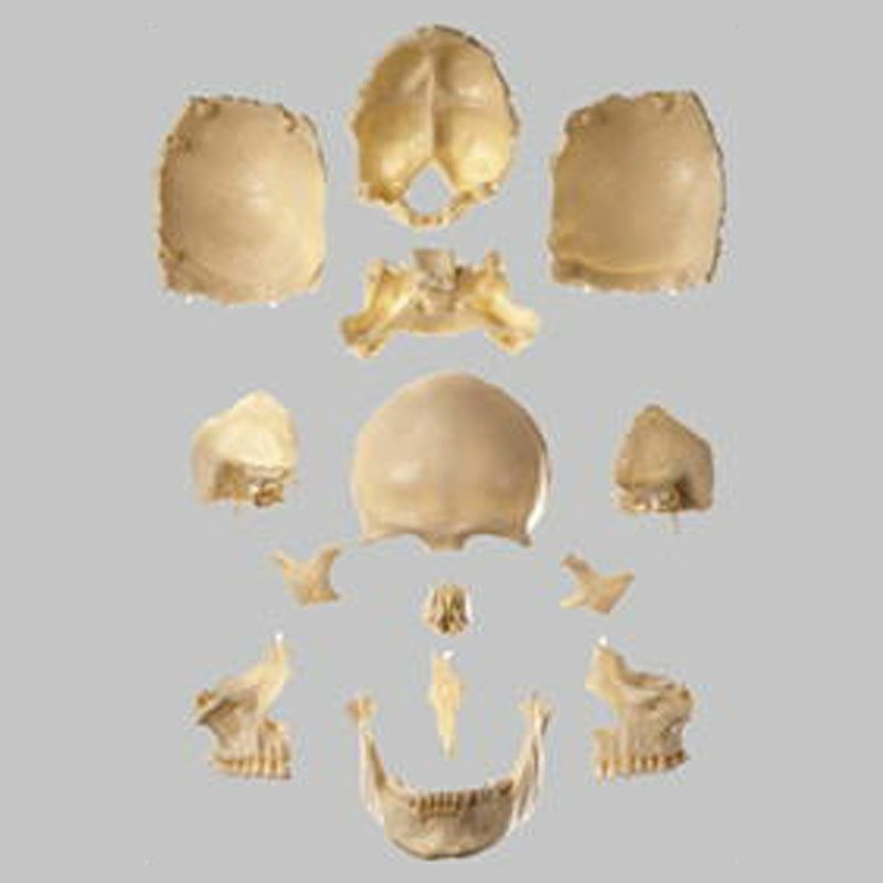 頭蓋骨分解模型 （１４分解、無地）