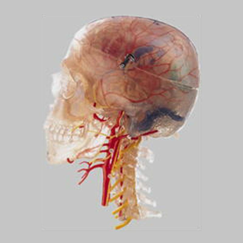 頸椎付頭部模型