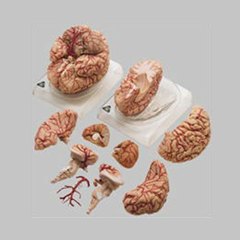 動脈付脳模型 | トワテック