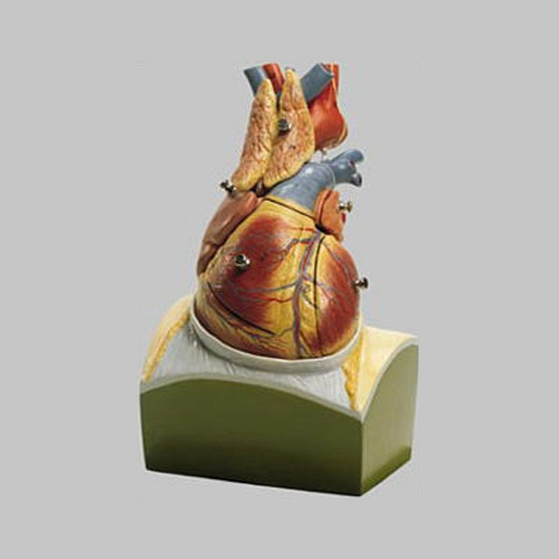 横隔膜上の心臓模型