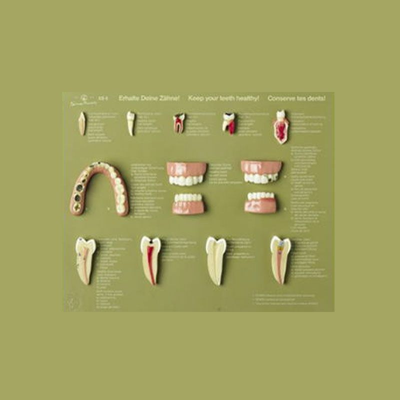 歯の展示ケース「貴方の歯を健康
に保つように心がけて下さい」