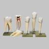 歯の５種類の模型