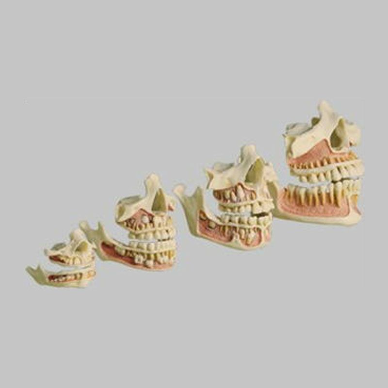 歯の発育模型（上下の顎完全露出）